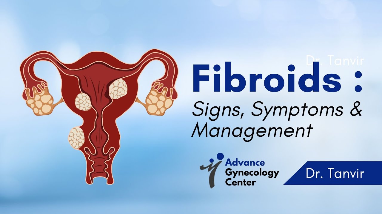 Fibroids Explained | Signs, Symptoms, Diagnosis, Risk Factors & Treatment | Dr. Tanvir