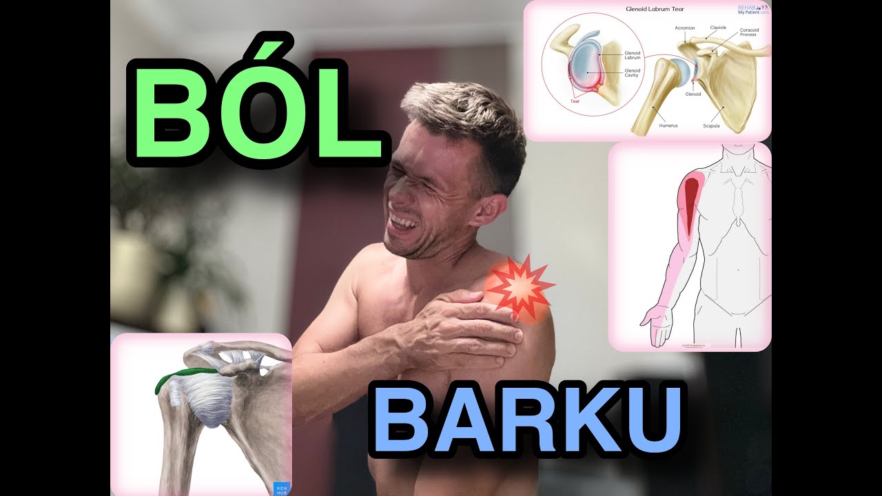 Ból Barku. Sprawdź od czego może boleć bark.