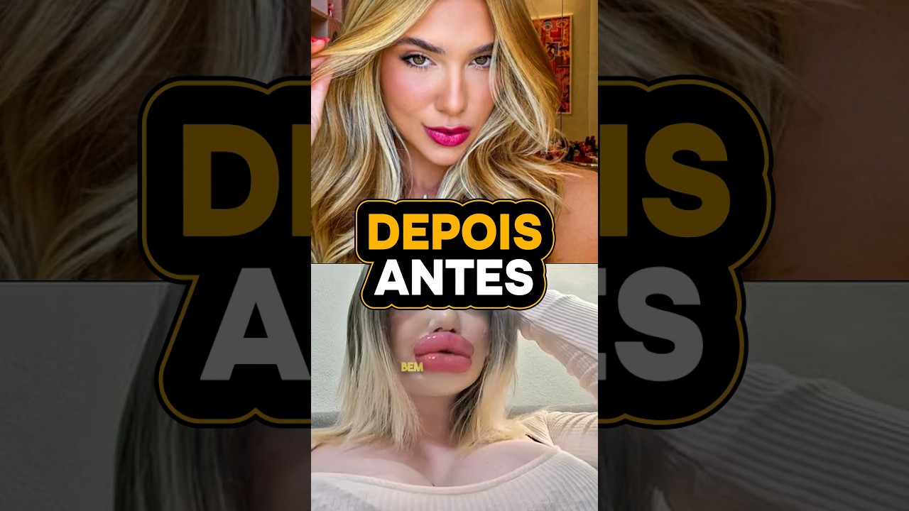 ANTES E DEPOIS de Virg&iacute;nia Fonseca