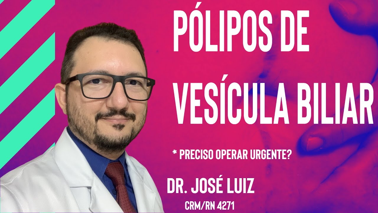Tenho Pólipo de Vesícula Biliar: o que é isso?