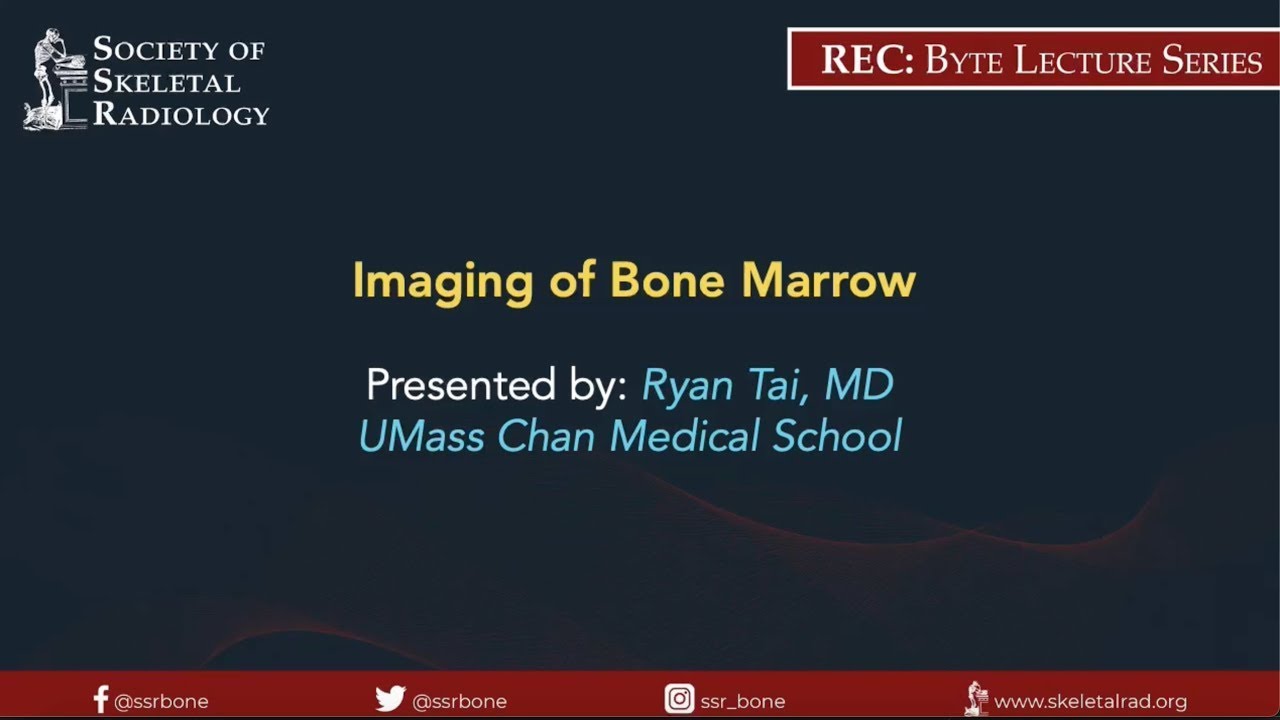Imaging of Bone Marrow