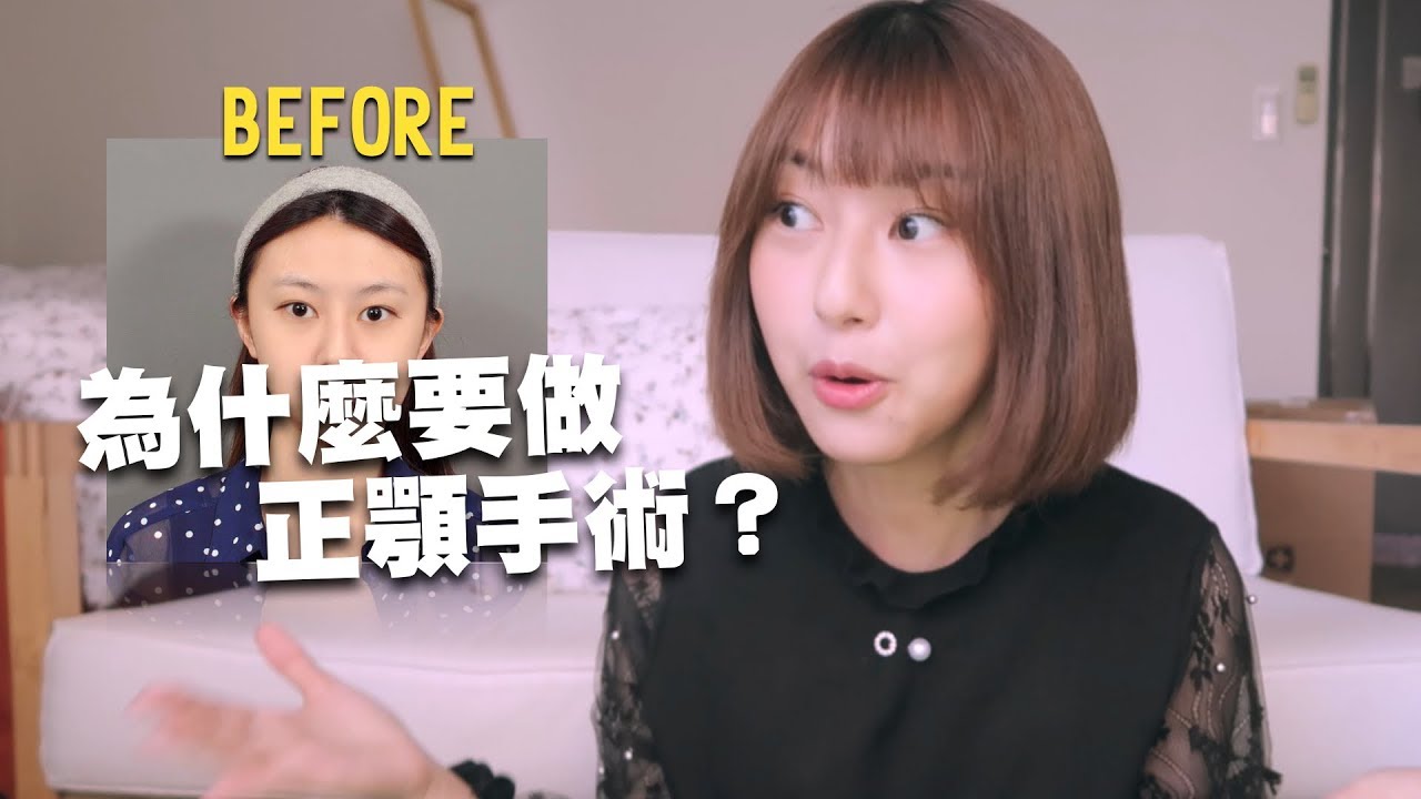 為什麼我要做正顎手術？BEFORE大公開｜心路歷程分享