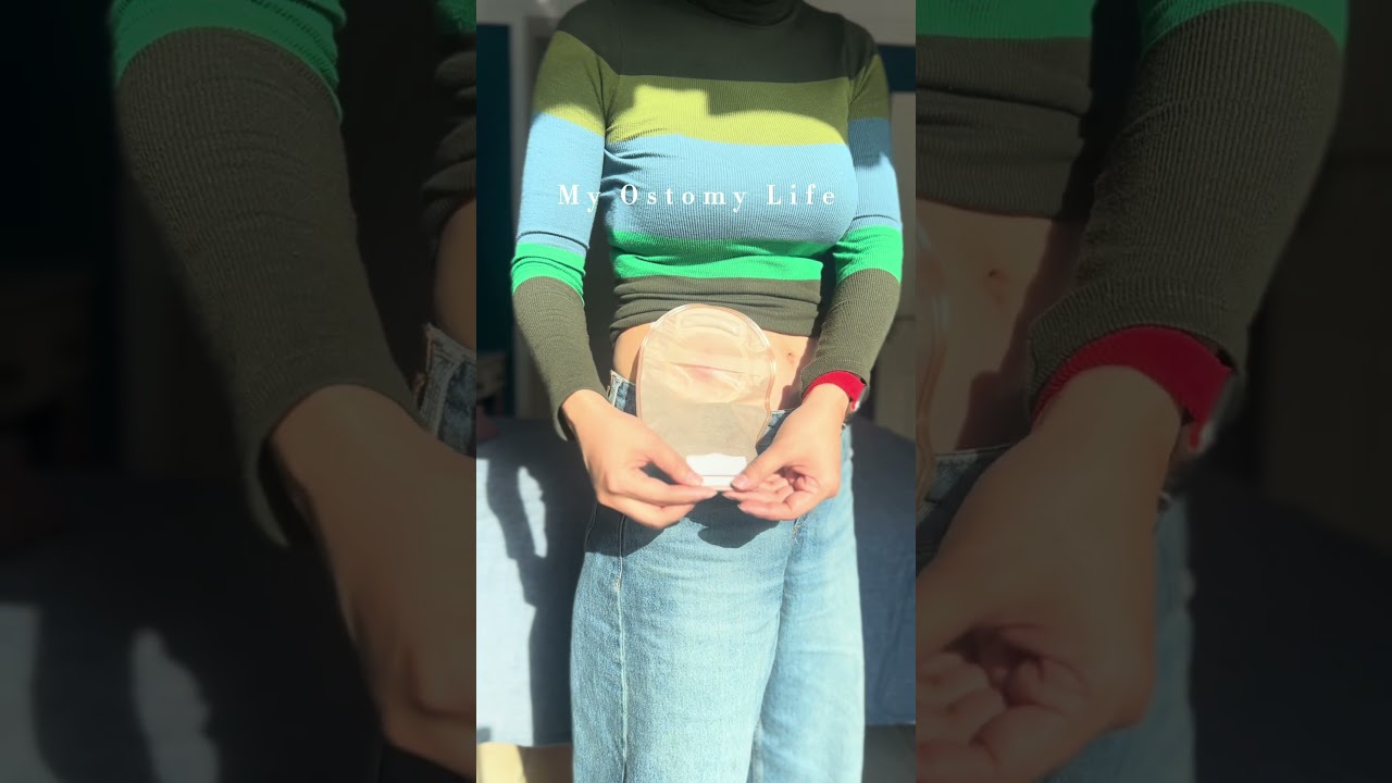 ✨ Convenience at its best! With Heagi 2-piece ostomy bags, switching is a breeze. #ostomybag #ostomy