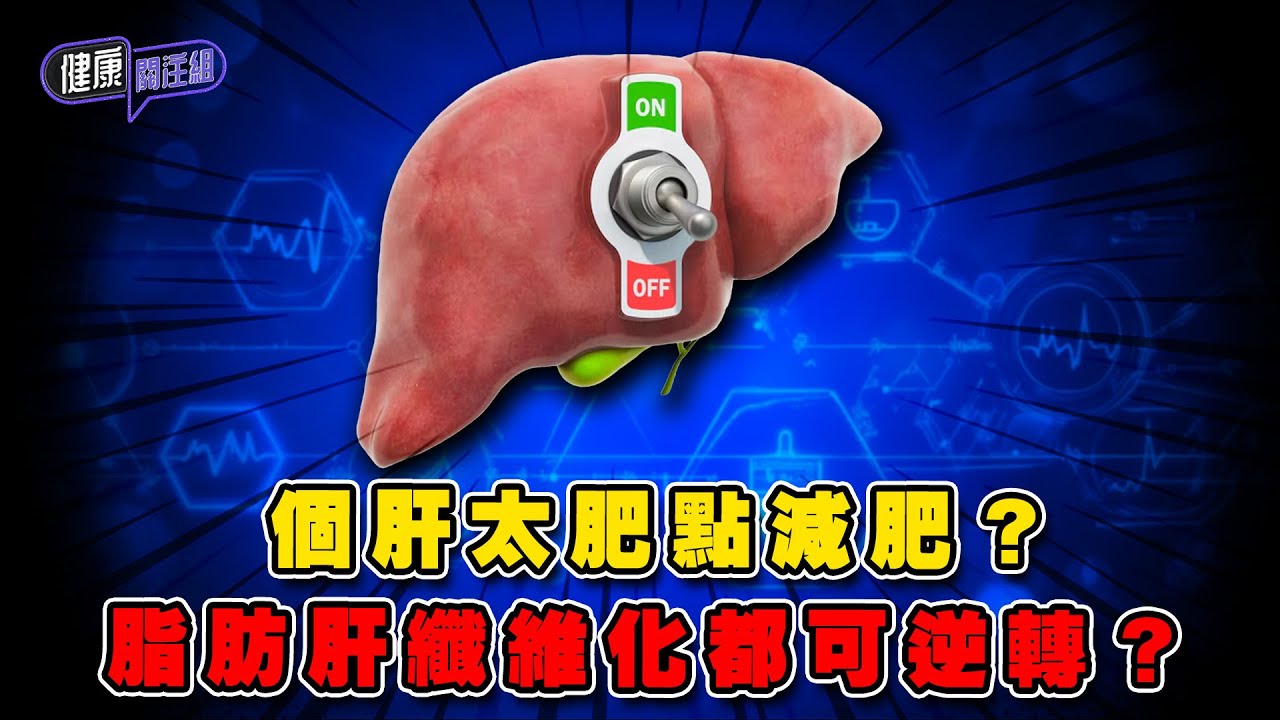 個肝太肥點減肥？脂肪肝纖維化都可逆轉？｜ 健康關注組 ｜ EP342 ｜ 脂肪肝 ｜ 肝纖維化 ｜ 肝硬化 ｜ 敖嘉年 ｜ 朱智賢 ｜ HOY TV 77台