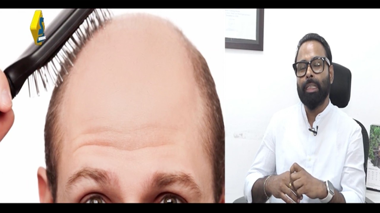 টাক পড়া থামান #hairloss