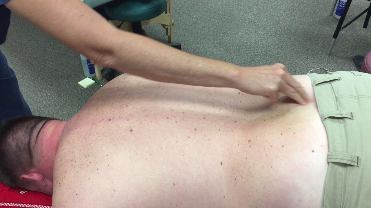 Dermagraphism Testing- Pre-Treatment- Male Patient