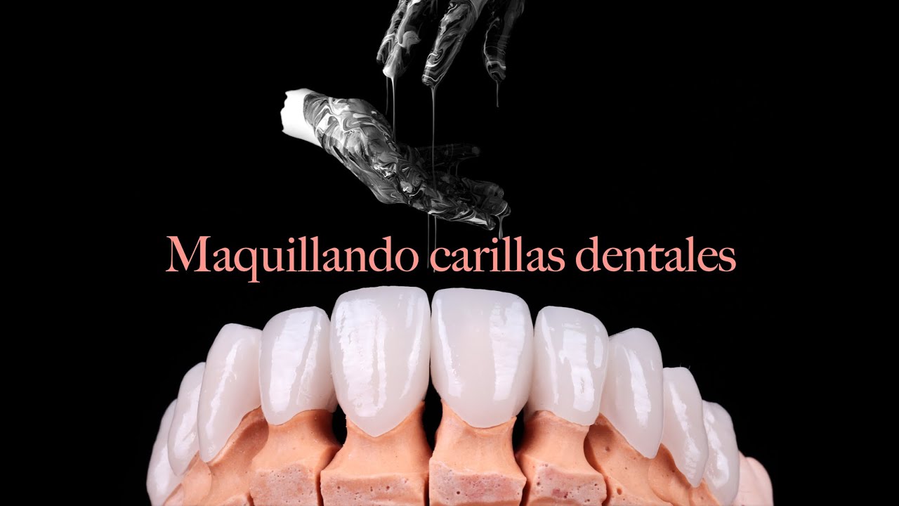Maquillando carillas dentales | Arte dental | Dr. Roberto Wuotto #carillasdentales