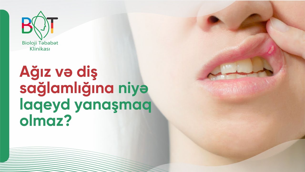 Ağız boşluğu xəstəliklərindən əziyyət çəkirsinizsə mütləq izləyin! |  DİQQƏTLİ OLUN!