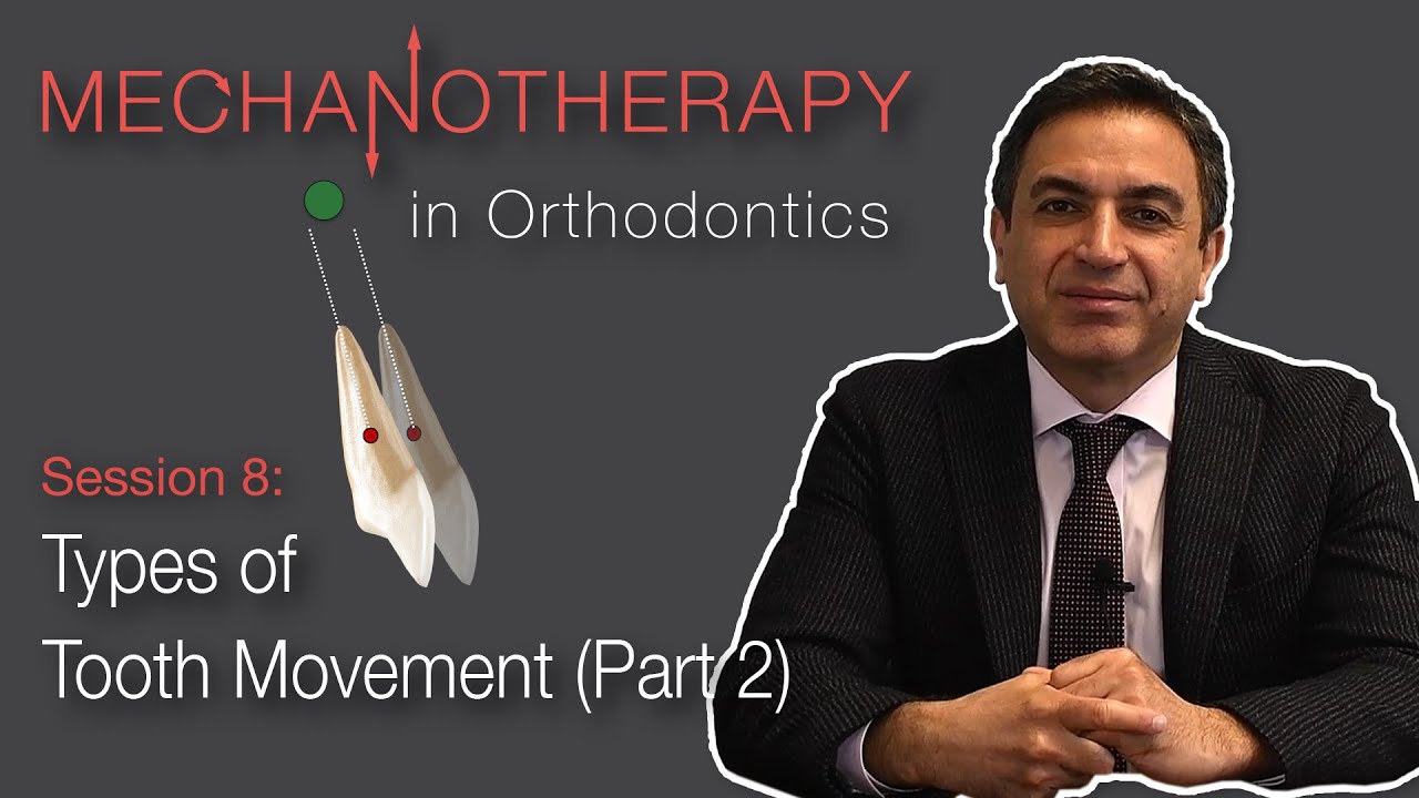 Mechanotherapy in Orthodontics: Types of Tooth Movement Pt. 2