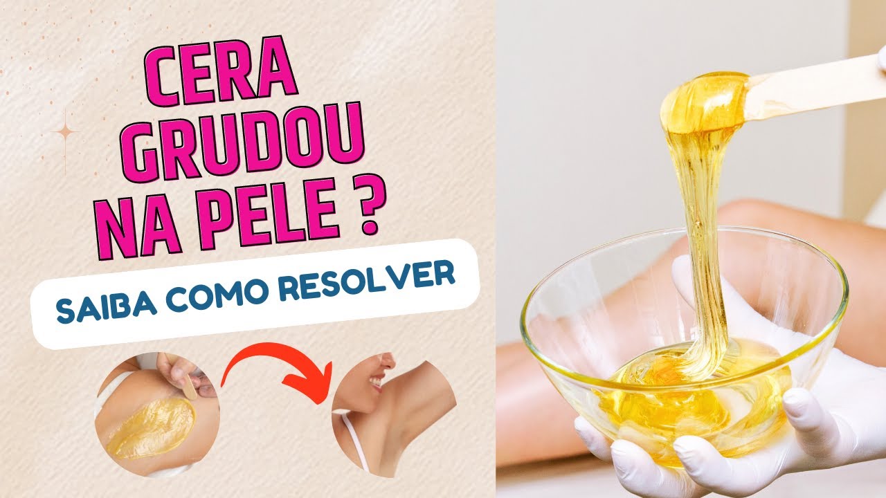Cera grudou e agora? Tutorial rápido e simples de como tirar cera que grudou na pele!