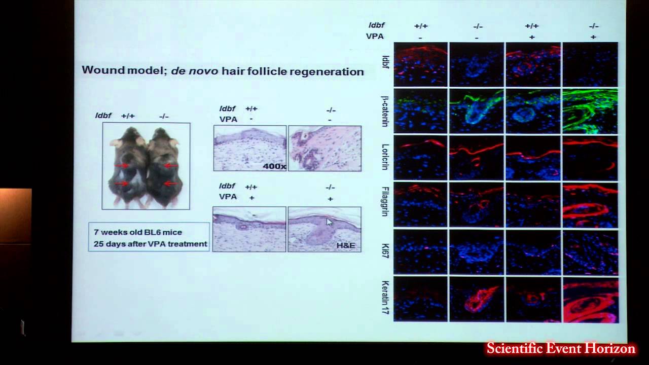 Professor Kang-Tell Choi: Activation of Hair Follicle Stem Cells Using WNT/Beta-Catenin Pathway