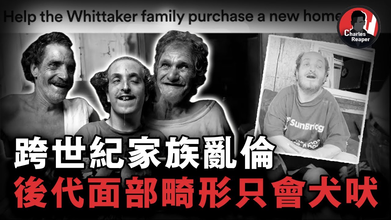 美國最恐怖的畸形家族，近親生子後代面部扭曲、不會說話只會狗吠，獵奇者拜訪差點命喪鄰居獵槍之下！| 叫我查爾斯好了 案件調查 案件解說 案件
