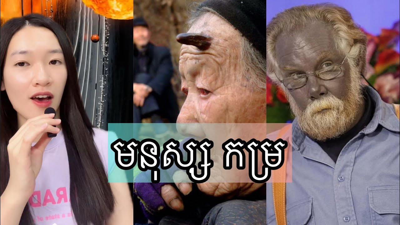 មនុស្ស កម្រ - People who are 1 in a million