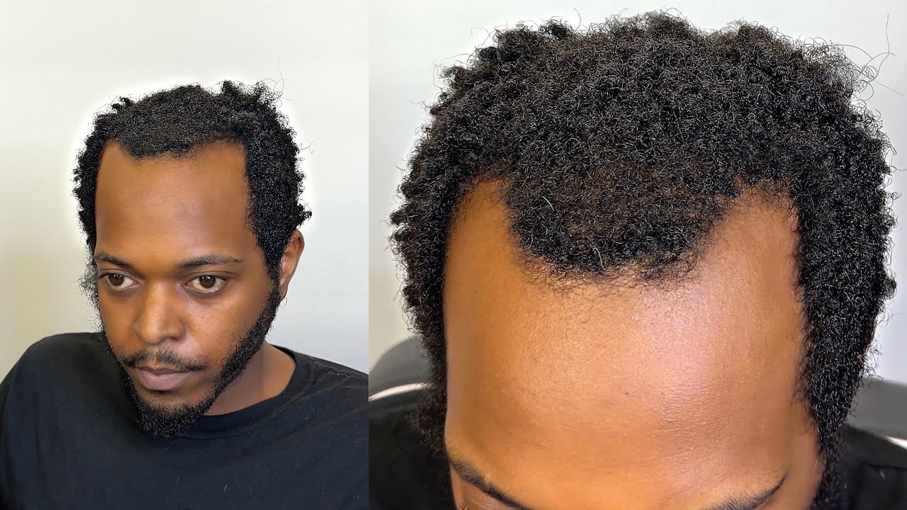 I think I finally MET MY MATCH with this DIFFICULT hairline😳😳