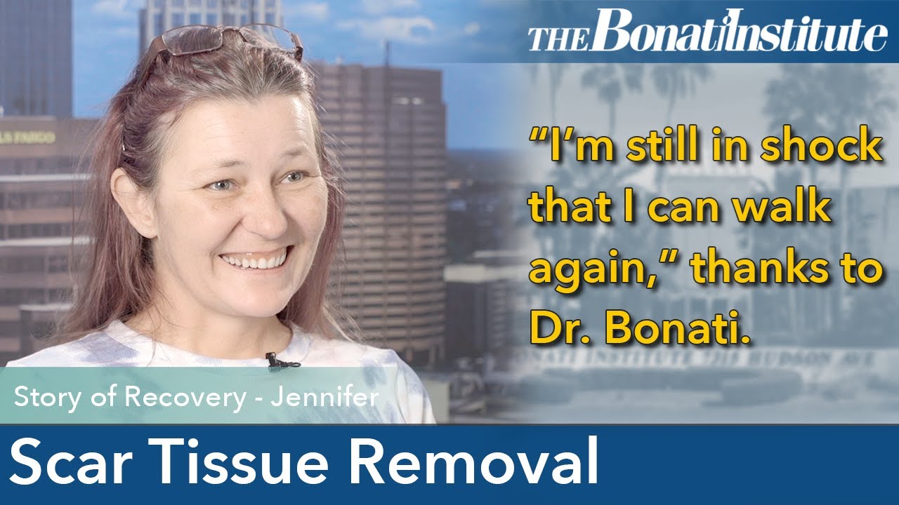 I'm still in shock that I can walk again thanks to Dr. Bonati | SCAR TISSUE REMOVAL