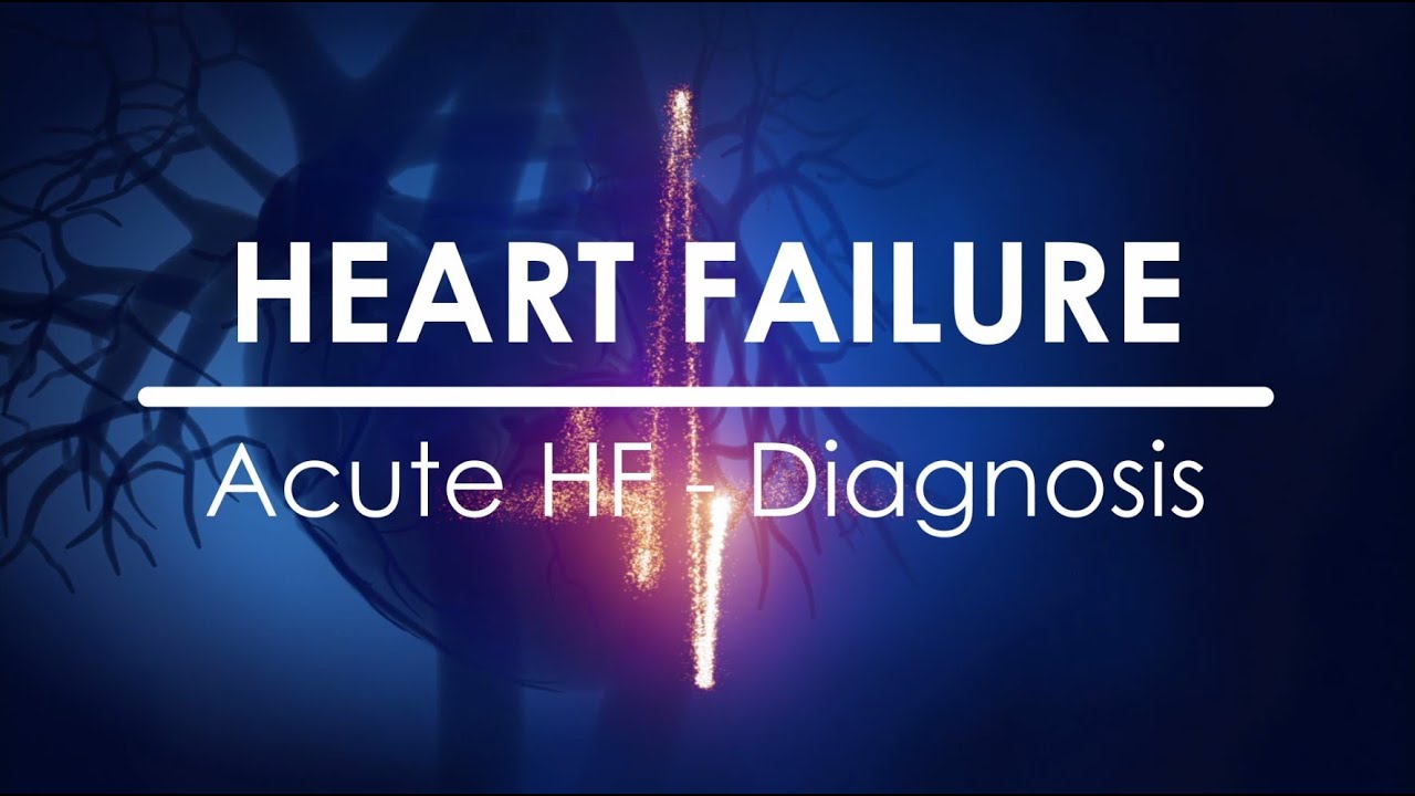 Scompenso Cardiaco Acuto - Diagnosi