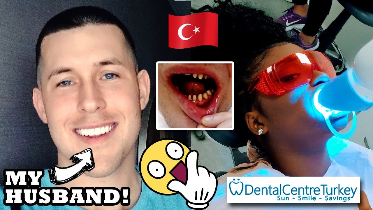😁 WE GOT OUR TEETH DONE! VLOG | Dental Centre Turkey | Smile Makeover Veneers & Crowns