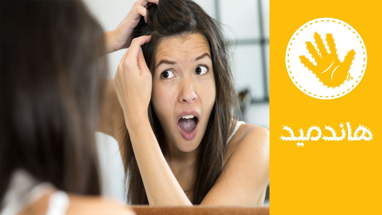 طرق طبيعية لعلاج قشرة الشعر | هاندميد