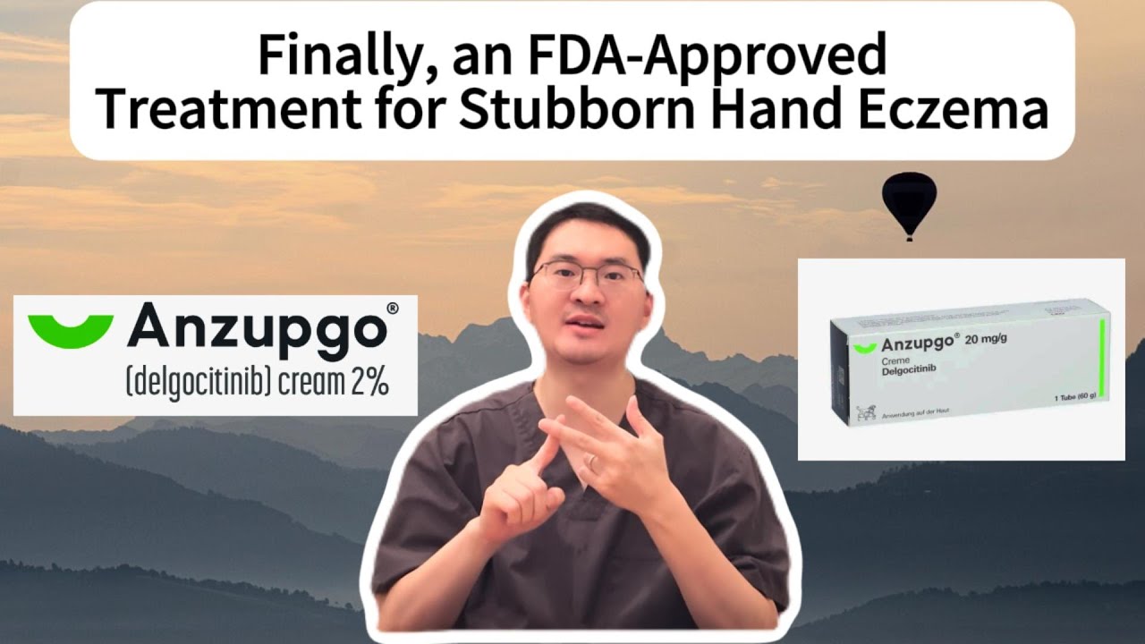 Five Things Must Know for Anzupgo (Delgocitinib Cream 2%)!