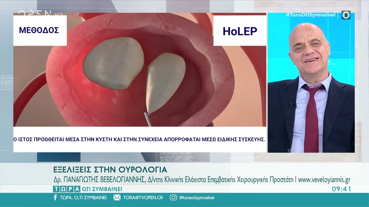 Rezum | Holep | Laser Λιθοτριψία : Το μέλλον είναι εδώ