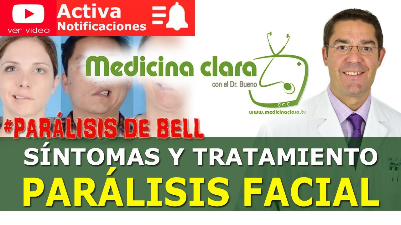 Par&aacute;lisis facial perif&eacute;rica, Par&aacute;lisis de Bell, Bell&acute;s Palsy &iquest;Qu&eacute; es exactamente? | Medicina Clara