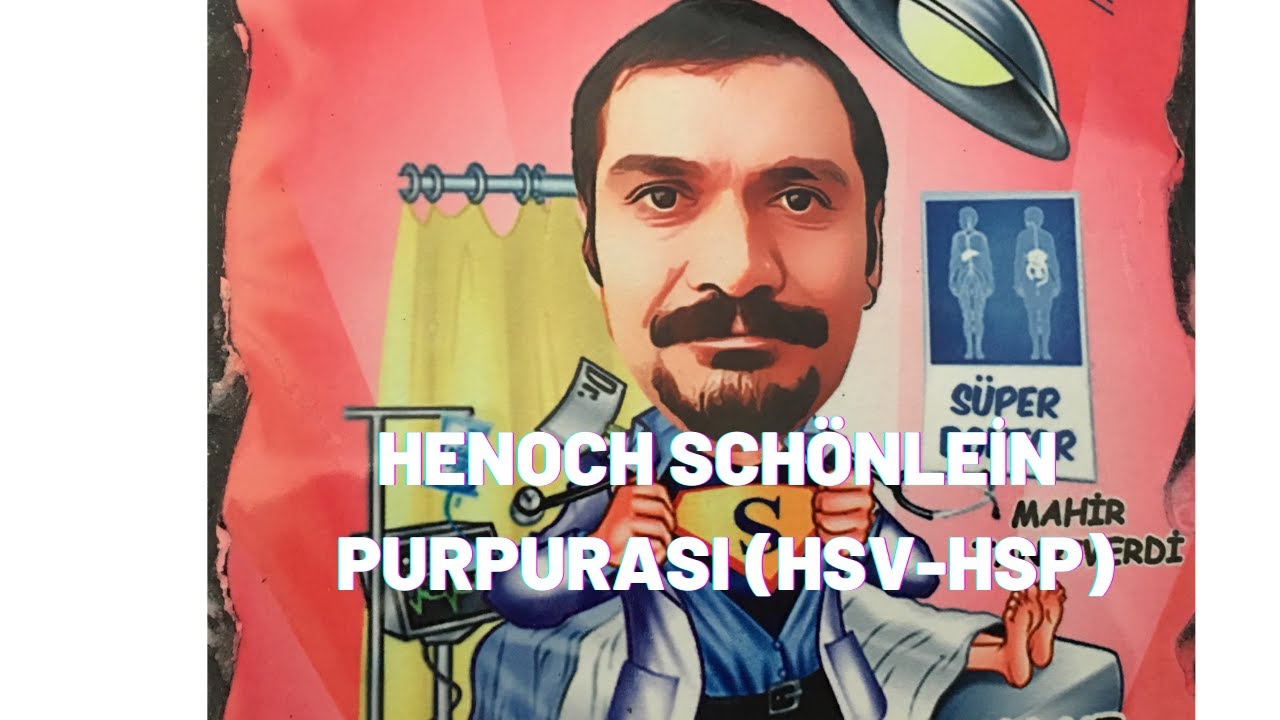 HENOCH SCHÖNLEİN VASKULİT ( HENOCH SCHÖNLEİN PURPURASI)