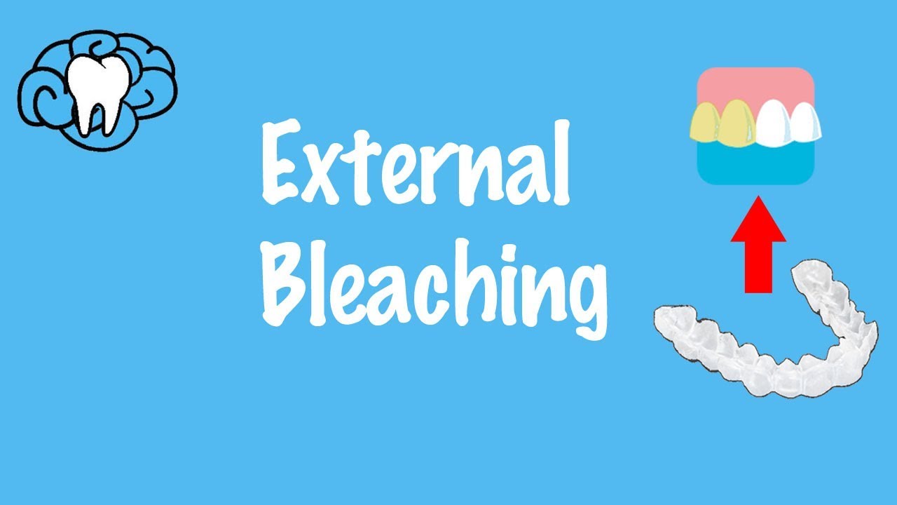 External Bleaching
