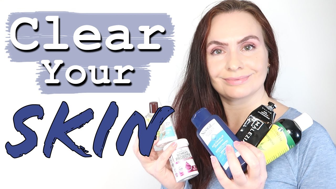How to Get Rid of Fungal Acne, Acne + Malassezia Folliculitis | FACE + BODY