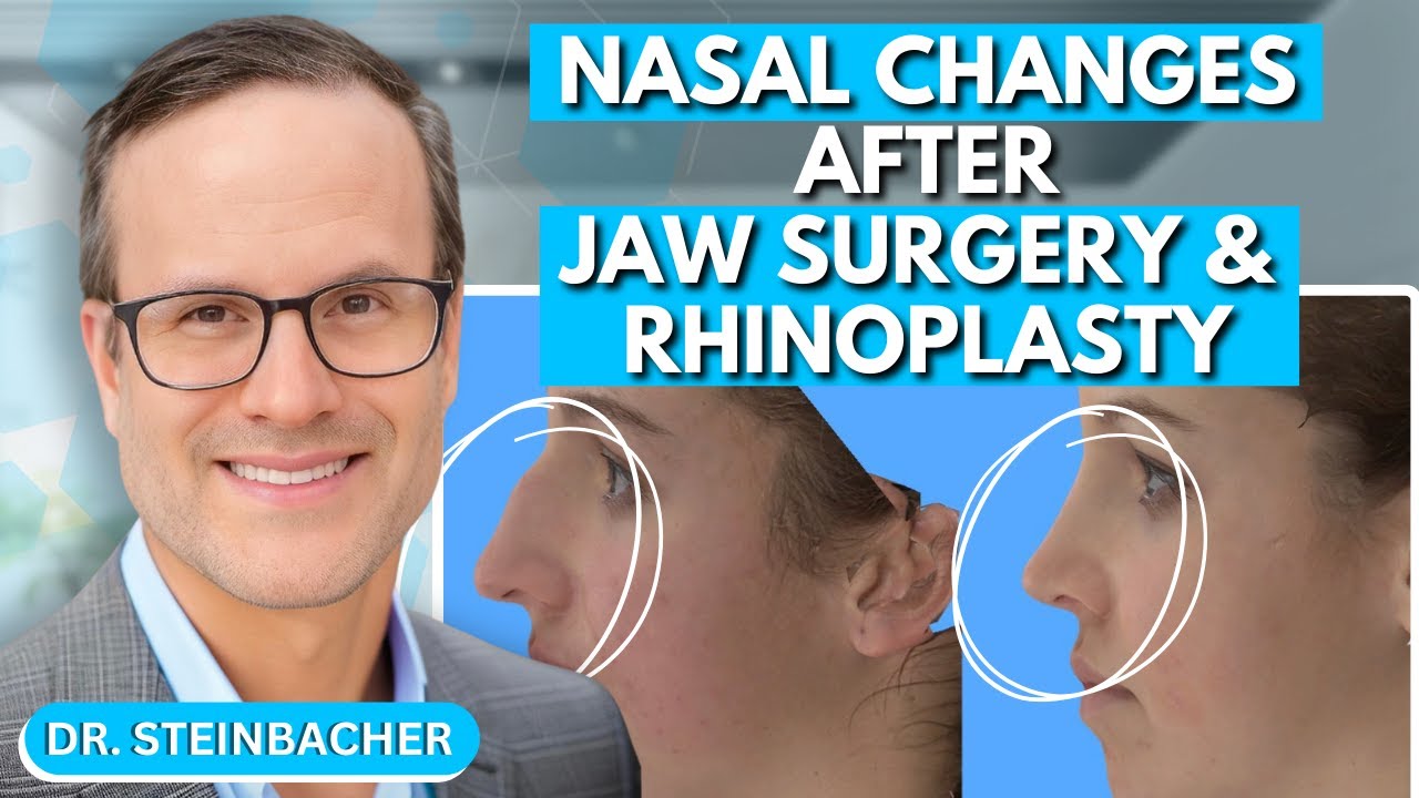 Nasal Changes After Orthognathic Jaw Surgery and Rhinoplasty | Dr. Derek Steinbacher