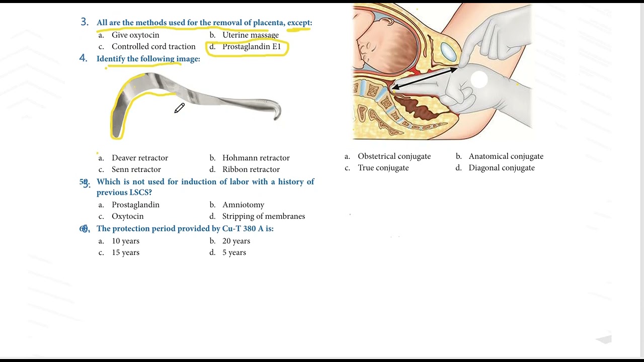 NORCET PYQ QUESTION SERIES // AIIMS NORCET // RRB // SGPGI // KGMU// ALL STATE CHO // STAFF NURSE
