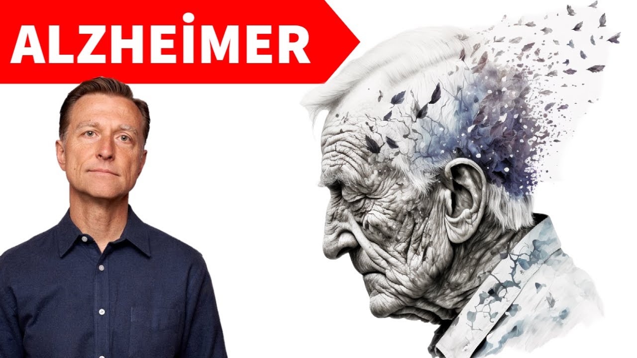 Alzheimer Hastalığının Asıl Nedeni Beyindeki Amiloid Plak Değildir | Dr.Berg Türkçe