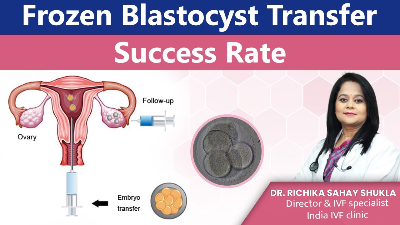 Frozen Blastocyst Transfer Success Rate : Dr Richika Sahay Shukla