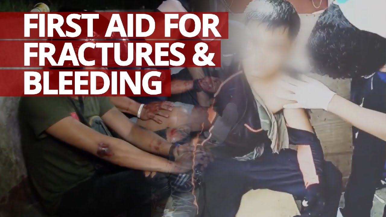 How to Manage Accidents Involving Fracture and Bleeding #Lifesaver #FirstAid