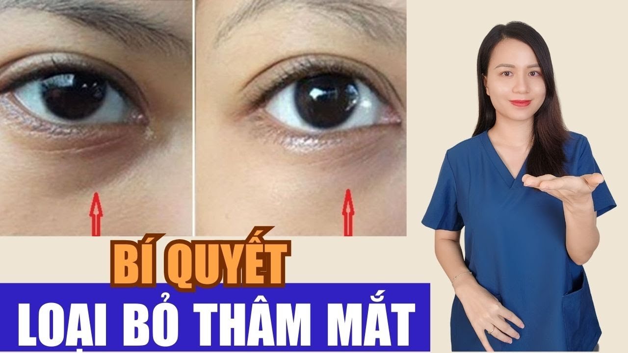 3 cách hết thâm mắt, xoá sổ mắt thâm đen siêu nhanh chóng | Nguyễn Mai Hương