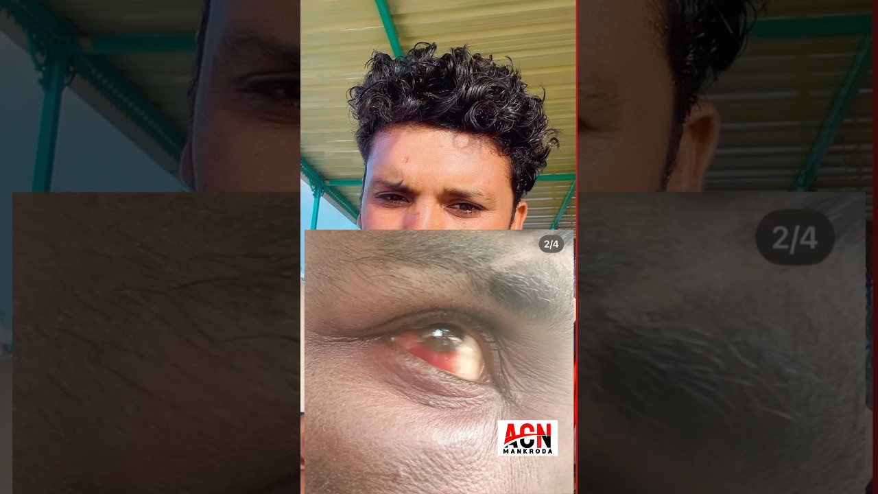 Jalore resonates with accusations of urinating on the face, demands for justice intensify