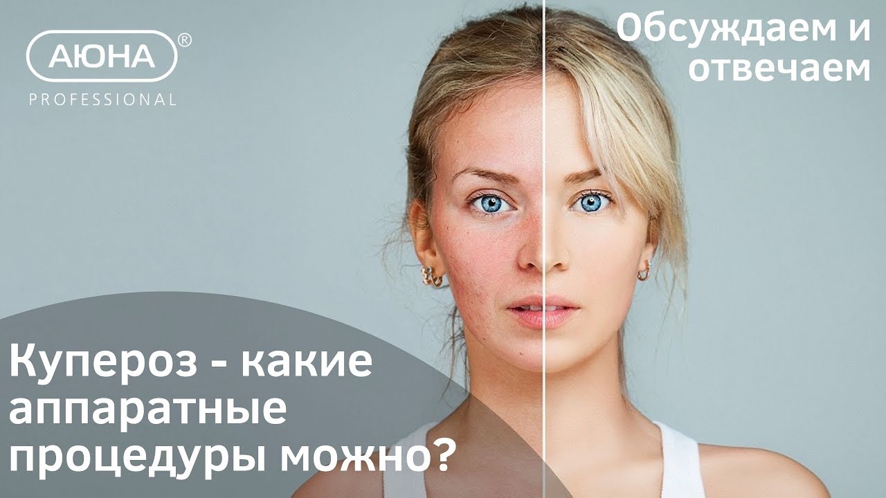 КУПЕРОЗ и аппаратные процедуры: что можно и что нельзя?