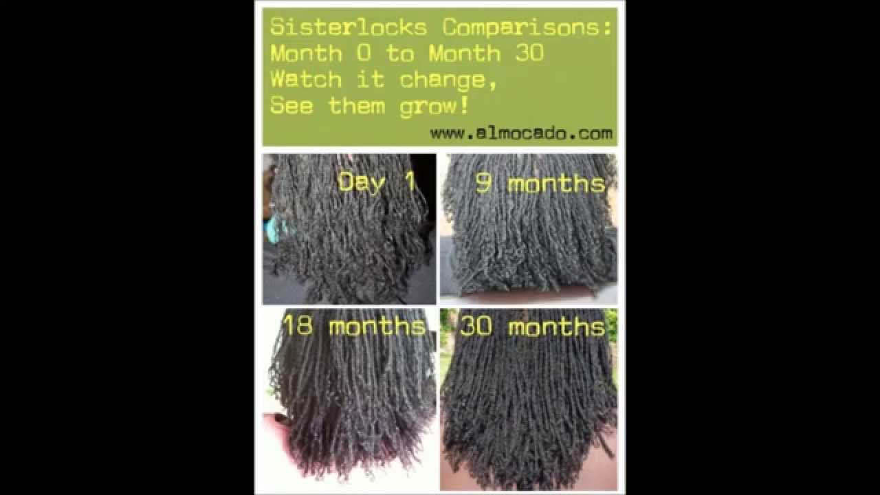 Sisterlocks Journeys Almocado Stories -  Client # 1 3 Yrs on