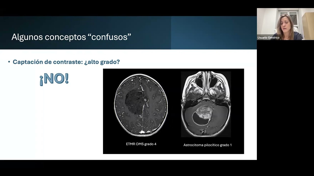 Aspectos radiológicos de los tumores cerebrales del niño y el adolescente