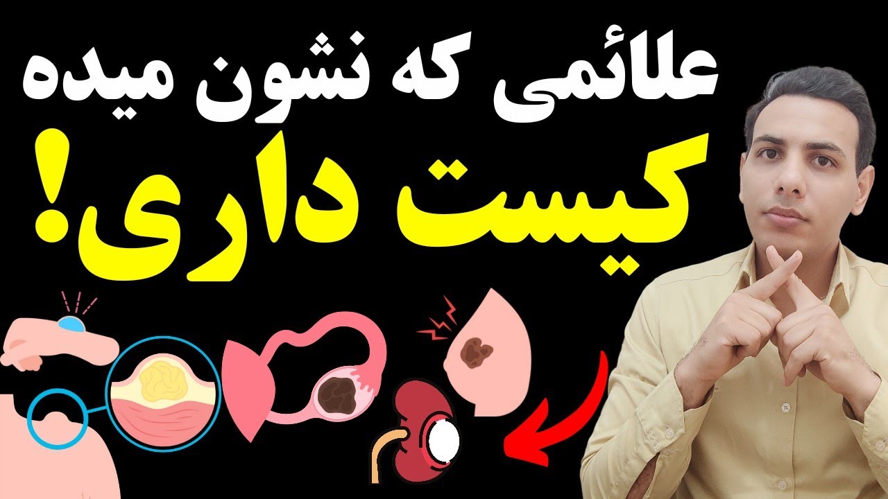 کجای بدنت کیست داره ؟ علائم هشدار کیست کیسه صفرا ، کبد و سایر اندام ها | دکتر خوب