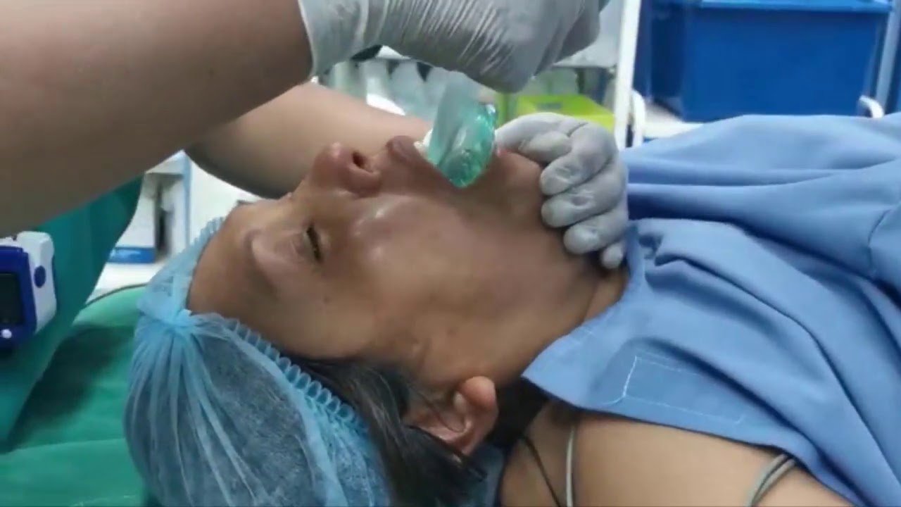 Manejo de vía aérea difícil con dispositivo I-GEL