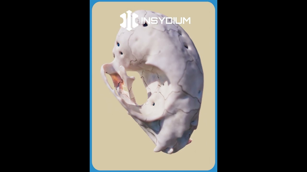 Инфекция, связанная с INSYDIUM