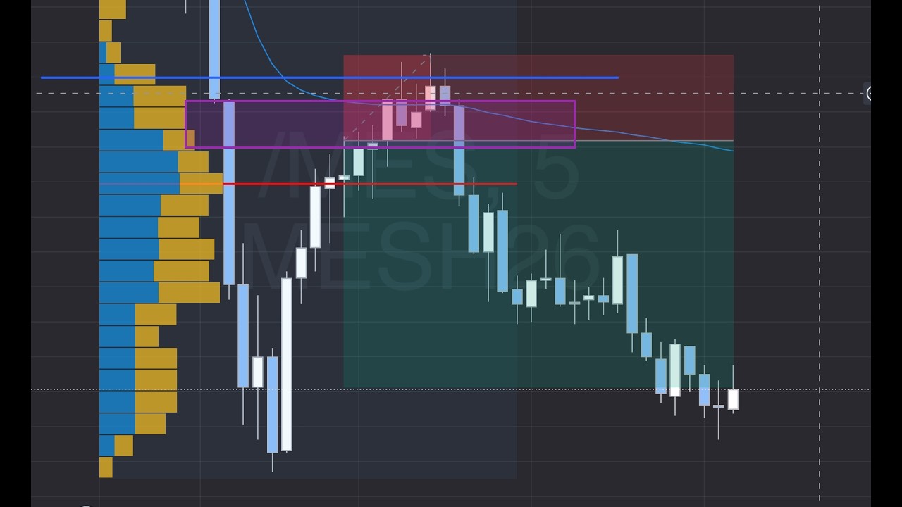Worst Trading Pain