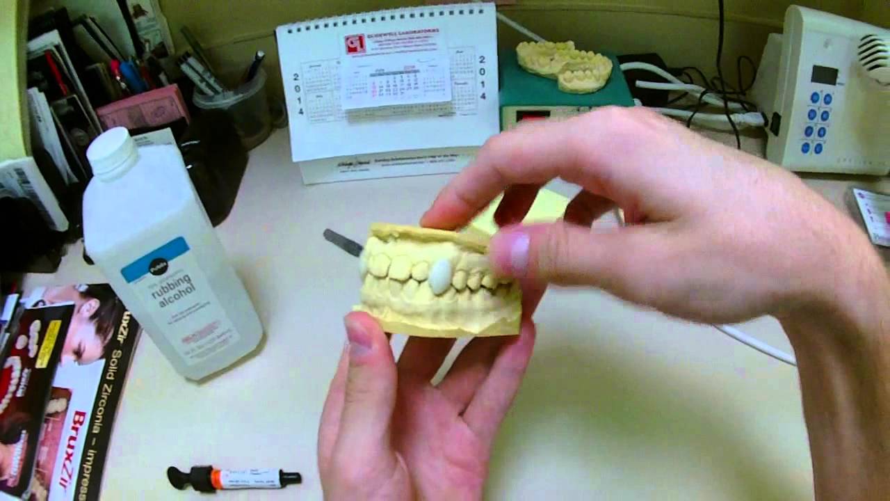 Dentist Makes Professional Movie FX Quality Vampire Fangs