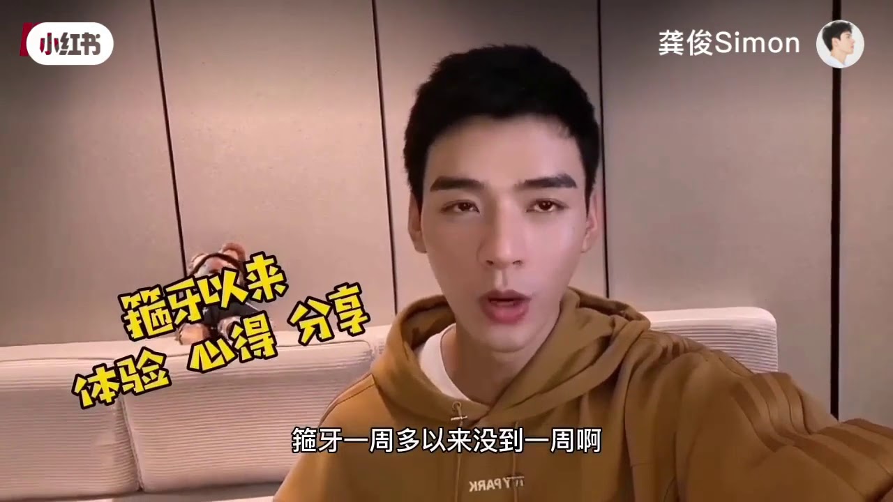 龔俊Gong Jun: The First Week with Braces 丨矫正牙齿第一周