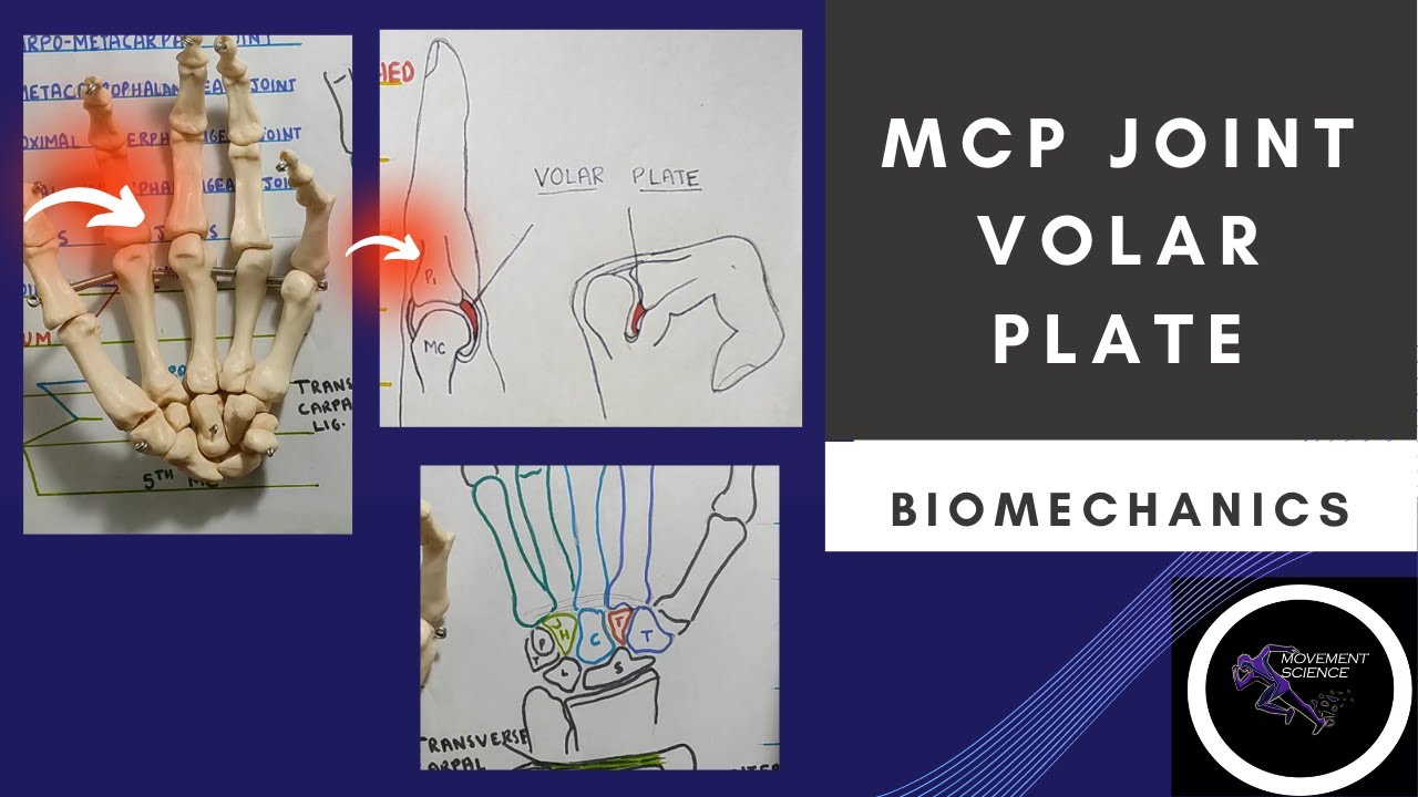 MCP JOINT - VOLAR PLATE( HAND  COMPLEX BIOMECHANICS)Physiotherapy