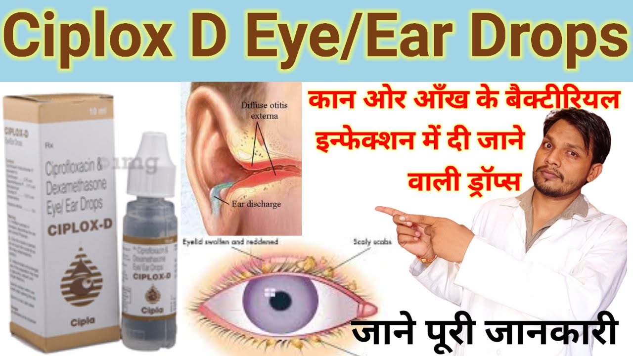 Ciplox-d Eye/Ear drops | Ciprofloxacin dexamethasone eye ear drops ciplox d | Ciplox d eye drop