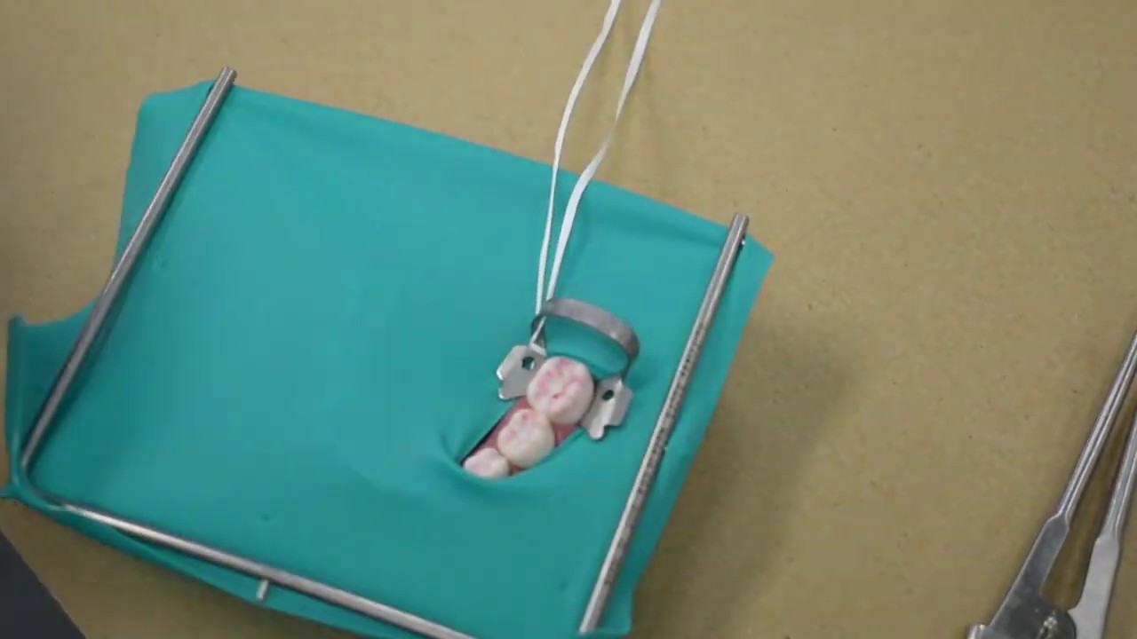 Split Dam Technique