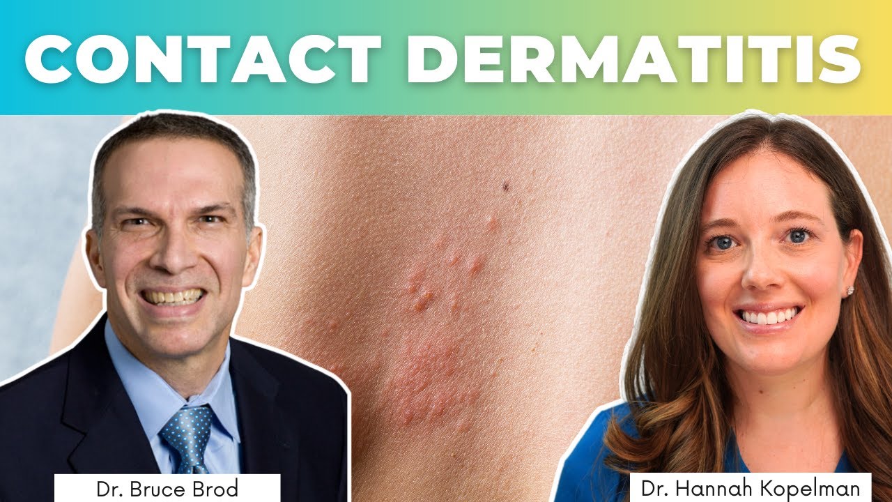 Treating Contact Dermatitis | Dr. Bruce Brod