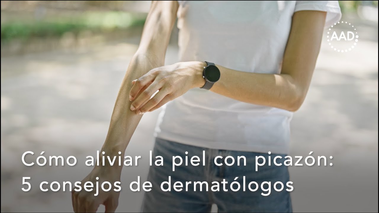 C&oacute;mo aliviar la picaz&oacute;n en la piel: 5 consejos del dermat&oacute;logo