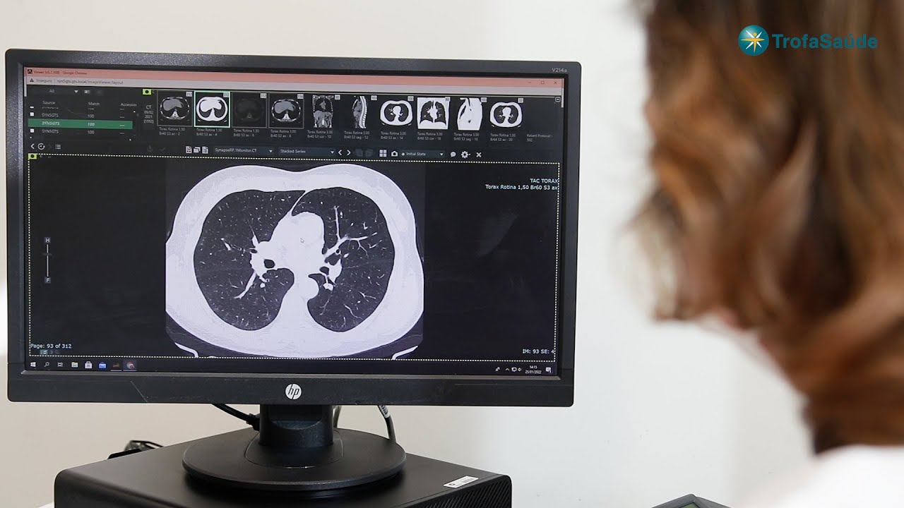😮&zwj;💨 Pneumologia: O que &eacute; e o que trata